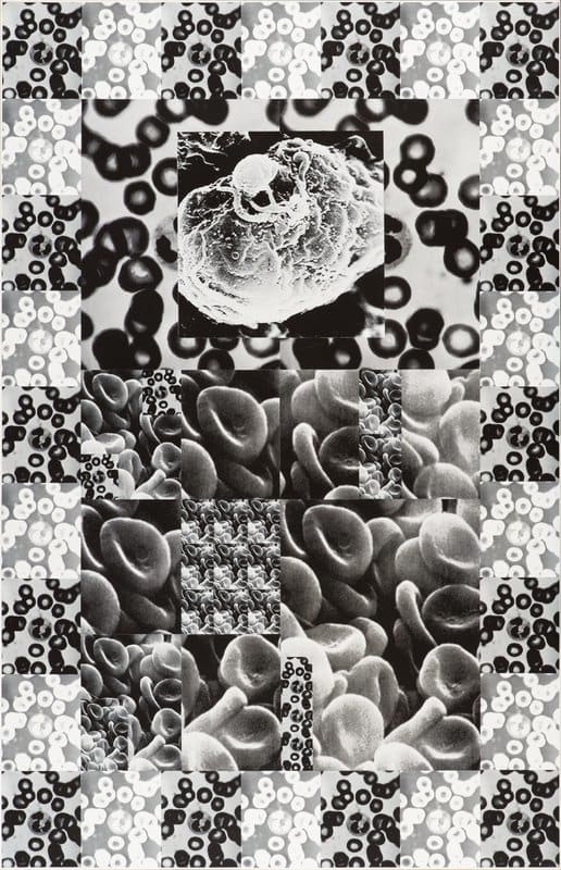 AIDS Pyramid by Carl Tandatnick, featuring black and white images of red and white blood cells as well as the AIDS virus.